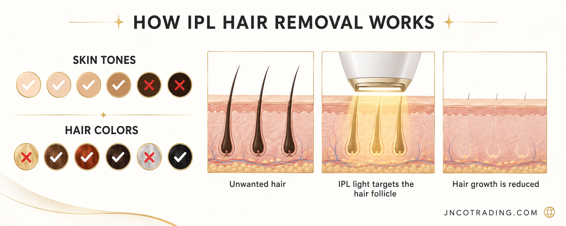 How IPL hair removal works, including suitable skin tones, hair colors, and the hair-growth reduction process